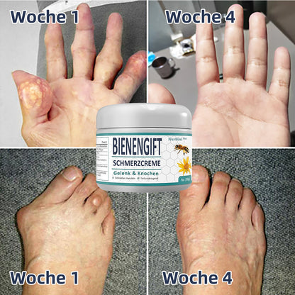 🐝Bienengift-Schmerzlinderungs- und Knochentherapiecreme🐝💥Begrenzter Rabatt für 30 Minuten⚡