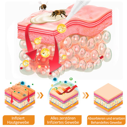 🐝🌿Dobshow™ Bienengift-Psoriasis-Linderungscreme🌿🐝(Wirksam bei allen Hauterkrankungen)🌟