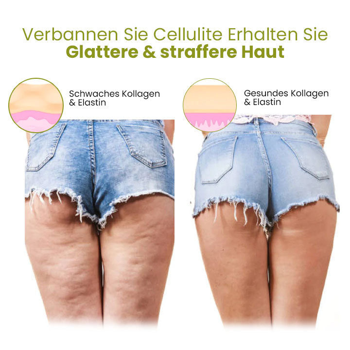 Fivfivgo™ HerbalFirm Cellulite Reduktion Pflaster