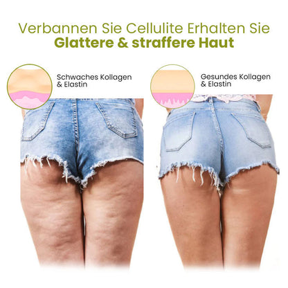 Fivfivgo™ HerbalFirm Cellulite Reduktion Pflaster